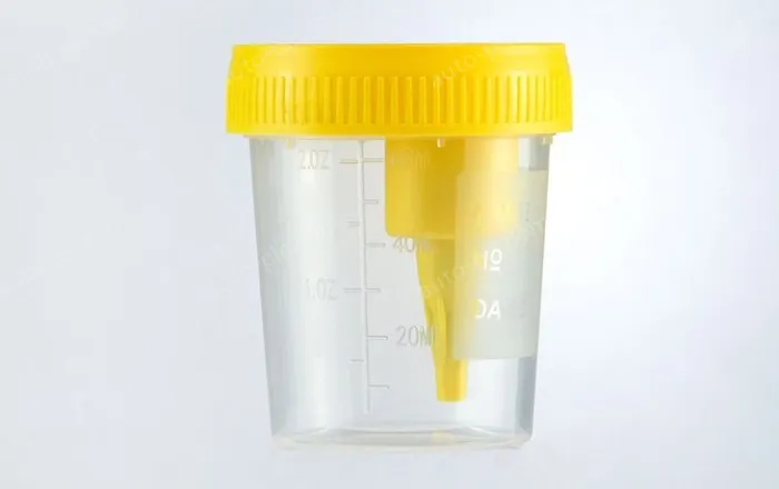 Negative pressure urine cup - 60ml